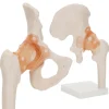 Model anatomiczny stawu biodrowego z więzadłami w skali 1:1